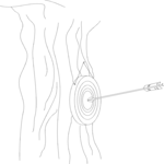 Archery - Bulls-Eye