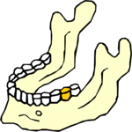 Jaw 1